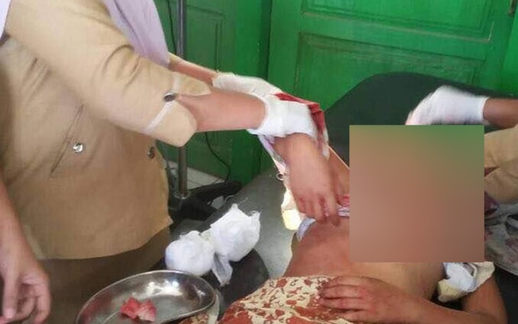 Korban saat sempat mendapat perawatan medis di Rumah Sakit Umum Cahaya Batin.