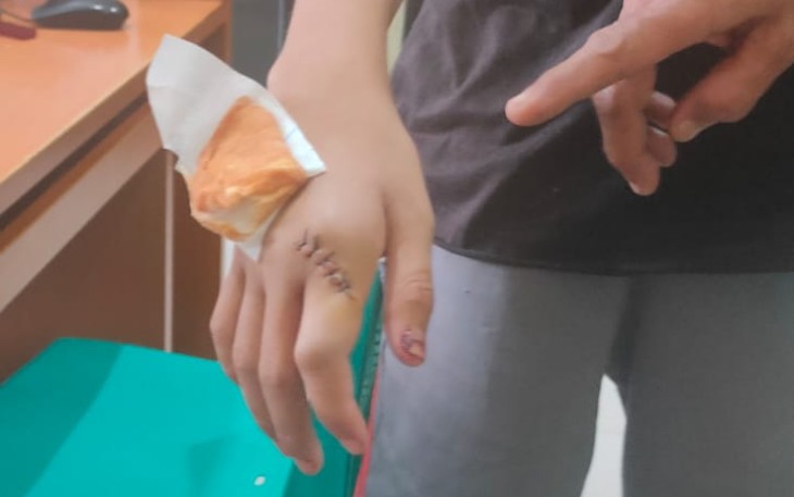 Anak Dianiaya, Bapak Lapor Polisi