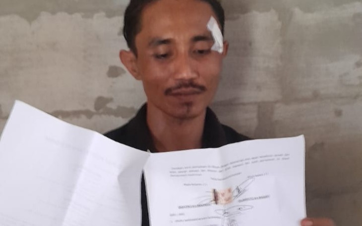 Rumristro Kaur Perencanaan Desa Biting Kecamatan Sambong korban penganiayaan yang dilakukan Ngatino Kades Biting.