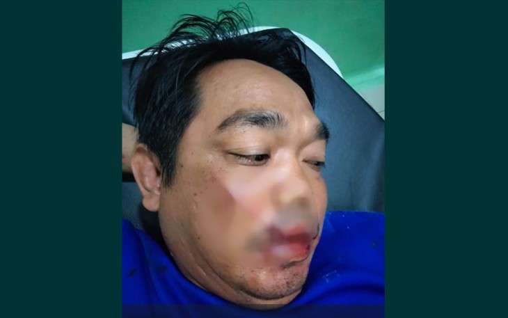 Korban saat mendapat perawatan medis 