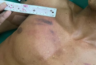 Santai Dalam Rumah, Petani Dianiaya Tetangga