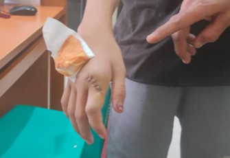 Anak Dianiaya, Bapak Lapor Polisi