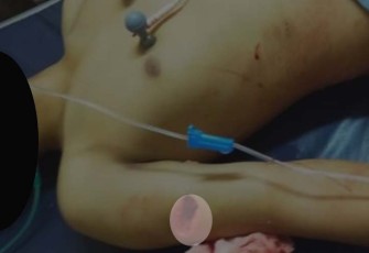 Korban tewas meski sempat dilarikan ke puskesmas terdekat