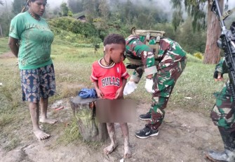 Obati penyakit kulit anak-anak Papua