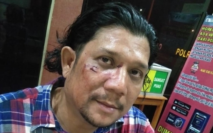 korban penganiayaan (Ketua SMSI Kabupaten Mandailingnatal (Madina) Jeffry Barata Lubis)