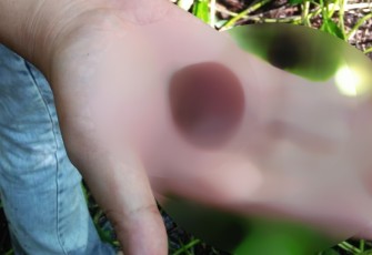 Diduga potongan kemaluan korban saat ditemukan petugas