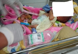 Perjuangan Bayi Arga Untuk Sembuh Dari Penyakit Hydrochephalus dan Spina Bifida