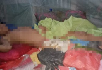 Korban Penganiayaan terbaring dirumahnya akibat mengalami pinggul bergeser dan patah tulang paha dianiaya oleh seseorang.